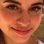 dermo-ness-dermopigmentation-taches-rousseur-valette-var