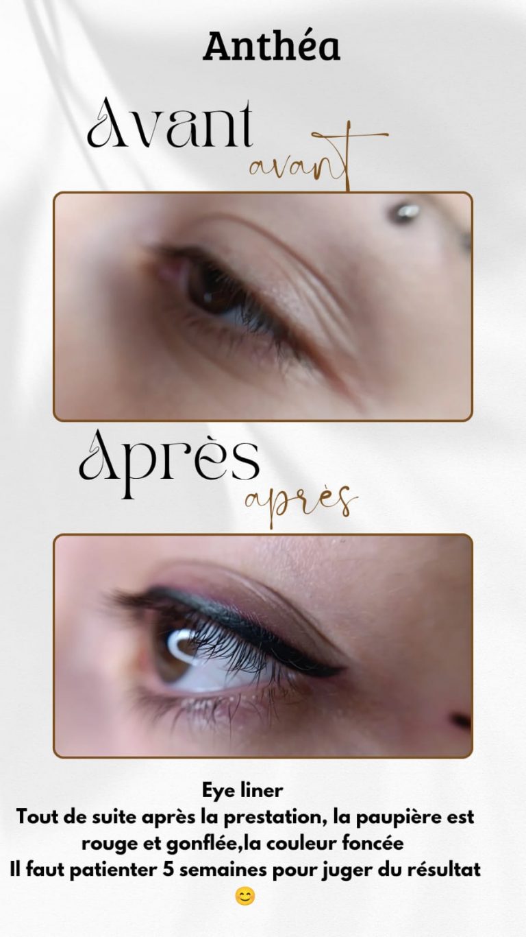 Dermo-ness La Valette du Var Eye liner maquillage permanent pas cher