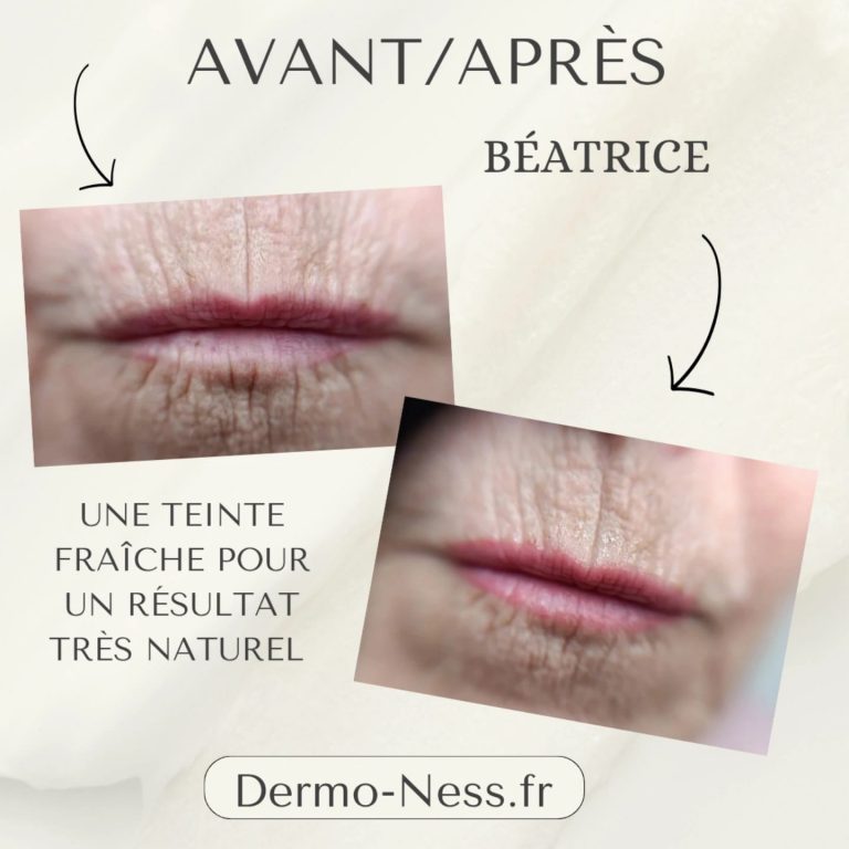 Dermo-Ness maquillage permanent lèvres bouche pas cher La Valette du Var Toulon